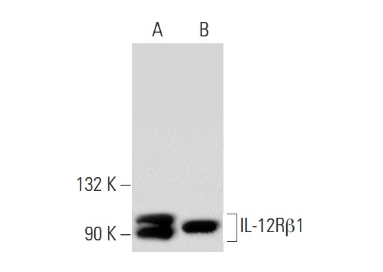 IL-12Rβ1 (C-20): sc-658. Western blot analysis of IL-12Rβ1 expression in human PBL (A) and mouse PBL (B) whole cell lysates.