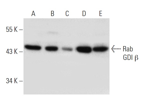 Rab GDI β (P-24): sc-133939. Western blot analysis of Rab GDI β expression in U-937 (A), A549 (B), NIH/3T3 (C), MCF7 (D) and SK-BR-3 (E) whole cell lysates and human liver tissue extract (F).