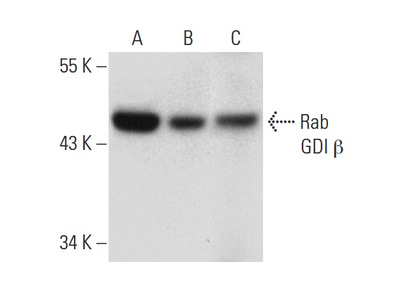 Rab GDI β (P-24): sc-133939. Western blot analysis of Rab GDI β expression in Hep G2 (A), Jurkat (B), NCI-H1299 (C), HeLa (D) and A-431 (E) whole cell lysates and mouse brain tissue extract (F).