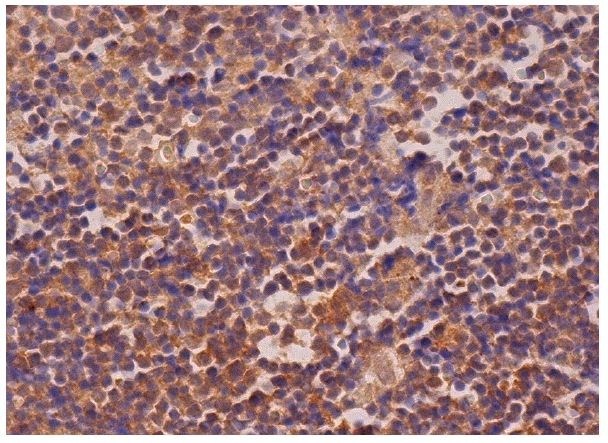 IL-1RAcP (D-5): sc-376872. Immunoperoxidase staining of formalin fixed, paraffin-embedded human lymph node tissue showing cytoplasmic staining of cells in germininal and non-germinal centers.