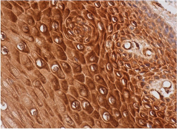 Ran GAP1 (N-19): sc-1862. Immunoperoxidase staining of formalin fixed, paraffin-embedded human uterine cervix tissue showing cytoplasmic and nuclear staining of squamous epithelial cells.