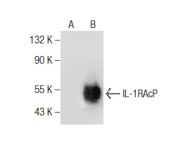 IL-1RAcP (N-20): sc-47056. Western blot analysis of IL-1RAcP expression in non-transfected: sc-117752 (A) and mouse IL-1RAcP transfected: sc-121041 (B) 293T whole cell lysates.
