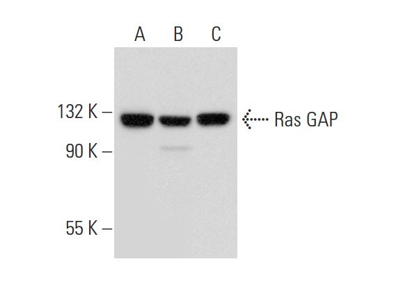 Ras GAP (B4F8): sc-63. Western blot analysis of Ras GAP expression in IMR-32 (A), HEK293 (B) and TT (C) whole cell lysates.