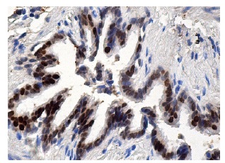 RCC1 (E-6): sc-55559. Immunoperoxidase staining of formalin fixed, paraffin-embedded human bronchus tissue showing nuclear staining of respiratory epithelial cells.