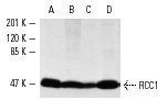RCC1 (N-19): sc-1161. Western blot analysis of RCC1 expression in NIH/3T3 (A), KNRK (B), Jurkat (C) and A-431 (D) whole cell lysates.