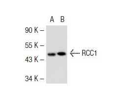 RCC1 (N-19): sc-1161. Western blot analysis of RCC1 expression in non-transfected: sc-117752 (A) and mouse RCC1 transfected: sc-125895 (B) 293T whole cell lysates.