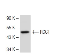RCC1 (N-19): sc-1161. Western blot analysis of RCC1 expression in HeLa whole cell lysate.