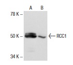 RCC1 (C-20): sc-1162. Western blot analysis of RCC1 expression in A-431 nuclear extract (A) and whole cell lysate (B).