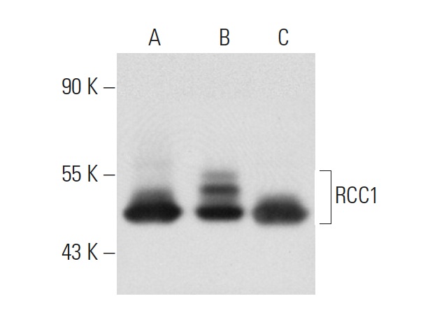 RCC1 (C-20): sc-1162. Western blot analysis of RCC1 expression in non-transfected 293T: sc-117752 (A), human RCC1 transfected 293T: sc-171495 (B) and Jurkat (C) whole cell lysates.