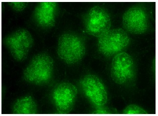 RCC1 (C-20): sc-1162. Immunofluorescence staining of methanol-fixed HeLa cells showing nuclear localization.