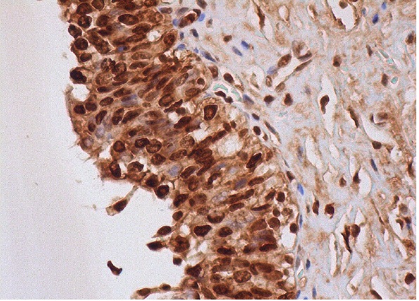 RCC1 (C-20): sc-1162. Immunoperoxidase staining of formalin fixed, paraffin-embedded human urinary bladder tissue showing nuclear and cytoplasmic staining of urothelial cells.
