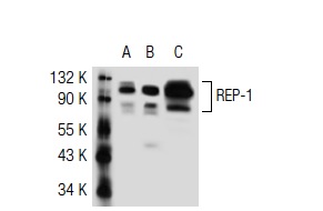 REP-1 (2F1): sc-23905. Western blot analysis of REP-1 expression in non-transfected 293T: sc-117752 (A), human REP-1 transfected 293T: sc-117225 (B) and Y79 (C) whole cell lysates.