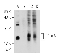 Western blot analysis of Rho A phosphorylation in untreated (A,C) and lambda protein phosphatase treated (B,D) mouse brain tissue extracts. Antibodies tested include p-Rho A (Ser 188): sc-32954 (A,B) and Rho A (119): sc-179 (C,D).