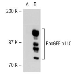 RhoGEF p115/Lsc (G-12): sc-74564. Western blot analysis of RhoGEF p115 expression in non-transfected: sc-117752 (A) and human RhoGEF p115 transfected: sc-113634 (B) 293T whole cell lysates.