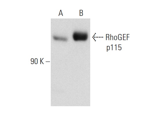 RhoGEF p115 (G-12): sc-74564. Western blot analysis of RhoGEF p115 expression in non-transfected: sc-117752 (A) and human RhoGEF p115 transfected: sc-175431 (B) 293T whole cell lysates.