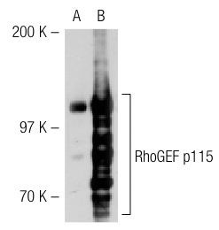 RhoGEF p115/Lsc (C-9): sc-74565. Western blot analysis of RhoGEF p115 expression in non-transfected: sc-117752 (A) and human RhoGEF p115 transfected: sc-113634 (B) 293T whole cell lysates.
