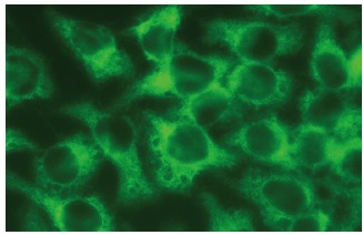 RhoGEF p115/Lsc (C-9): sc-74565. Immunofluorescence staining of methanol-fixed HeLa cells showing cytoplasmic localization.
