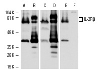 Western blot analysis of IL-2Rβ expression in HuT 78 (A,C,E) and CTLL-2 (B,D,F) whole cell lysates. Antibodies tested include IL-2Rβ (C-20): sc-671 (A,B), IL-2Rβ (M-20): sc-672 (C,D) and IL-2Rβ (S-20): sc-1046 (E,F).