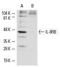 IL-8RB (K-19): sc-683. Western blot analysis of IL-8RB expression in whole cell lysates prepared from CHO-K1 cells transfected with IL-8RB (A) and non-transfected CHO-K1 cells (B).