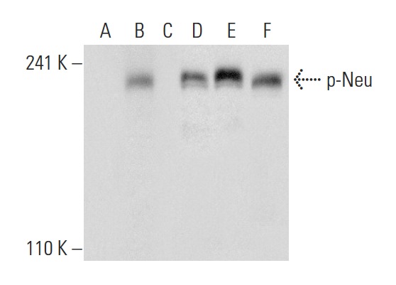 Western blot analysis of Neu phosphorylation in untreated (A,D), Neuregulin-1 treated (B,E) and Neuregulin-1 and lambda protein phosphatase (sc-200312A) treated (C,F) MCF7 whole cell lysates. Antibodies tested include p-Neu (Tyr 1248)-R: sc-12352-R (A,B,C) and Neu (3B5): sc-33684 (D,E,F).