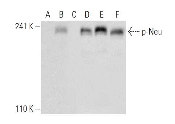 Western blot analysis of Neu phosphorylation in untreated (A,D), Neuregulin-1 treated (B,E) and Neuregulin-1 and lambda protein phosphatase (sc-200312A) treated (C,F) MCF7 whole cell lysates. Antibodies tested include p-Neu (Tyr 1221/1222): sc-101694 (A,B,C) and Neu (3B5): sc-33684 (D,E,F).