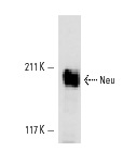 Neu (3B5): sc-33684. Western blot analysis of Neu expression in SK-BR-3 whole cell lysate.