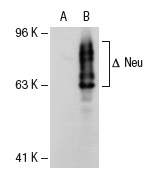 Neu (3B5): sc-33684. Western blot analysis of Neu expression in non-transfected: sc-117752 (A) and truncated mouse Neu transfected: sc-125694 (B) 293T whole cell lysates.