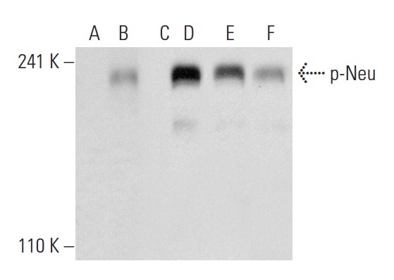 Western blot analysis of Neu phosphorylation in untreated (A,D), Neuregulin-1 treated (B,E) and Neuregulin-1 and lambda protein phosphatase (sc-200312A) treated (C,F) T-47D whole cell lysates. Antibodies tested include p-Neu (Tyr 1248)-R: sc-12352-R (A,B,C) and Neu (3B5): sc-33684 (D,E,F).