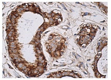 Neu (3B5): sc-33684. Immunoperoxidase staining of formalin fixed, paraffin-embedded human breast tissue showing cytoplasmic and membrane staining of glandular cells.