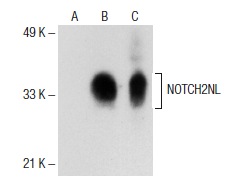 NOTCH2NL (39-Y): sc-100307. Western blot analysis of NOTCH2NL expression in non-transfected 293T: sc-117752 (A), human NOTCH2NL transfected 293T: sc-112401 (B) and HeLa (C) whole cell lysates.
