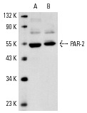 PAR-2 (SAM11): sc-13504. Western blot analysis of PAR-2 expression in NIH/3T3 (A) and KNRK (B) whole cell lysates.