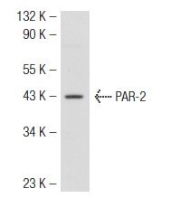 PAR-2 (SAM11): sc-13504. Western blot analysis of PAR-2 expression in WiDr whole cell lysate.