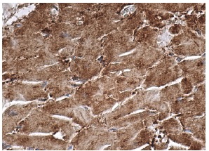 PAR-2 (SAM11): sc-13504. Immunoperoxidase staining of formalin fixed, paraffin-embedded human heart muscle tissue showing cytoplasmic staining of myocytes.