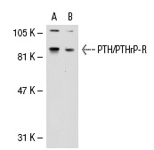 PTH/PTHrP-R (3D1.1): sc-12722. Western blot analysis of PTH/PTHrP-R expression in non-transfected: sc-117752 (A) and human PTH/PTHrP-R transfected: sc-114269 (B) 293T whole cell lysates.