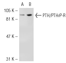 PTH/PTHrP-R (3D1.1): sc-12722. Western blot analysis of PTH1R expression in non-transfected: sc-117752 (A) and human PTH1R transfected: sc-112476 (B) 293T whole cell lysates.