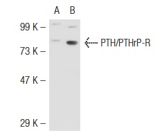 PTH/PTHrP-R (3D1.1): sc-12722. Western blot analysis of PTH/PTHrP-R expression in non-transfected: sc-117752 (A) and mouse PTH/PTHrP-R transfected: sc-122836 (B) 293T whole cell lysates.