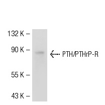 PTH/PTHrP-R (3D1.1): sc-12722. Western blot analysis of PTH/PTHrP-R expression in Caki-1 whole cell lysate.