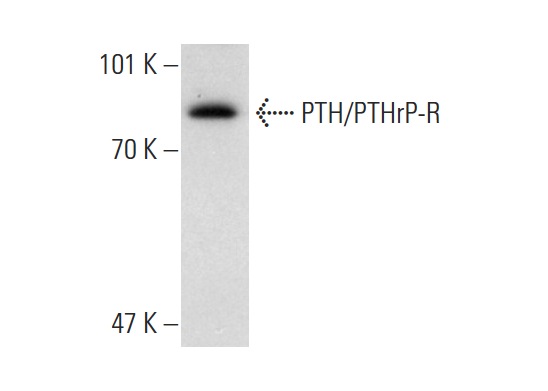 PTH/PTHrP-R (3D1.1): sc-12722. Western blot analysis of PTH/PTHrP-R expression in Caco-2 whole cell lysate.