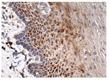 PTH/PTHrP-R (3D1.1): sc-12722. Immunoperoxidase staining of formalin fixed, paraffin-embedded human esophagus tissue showing cytoplasmic staining of squamous epithelial cells.