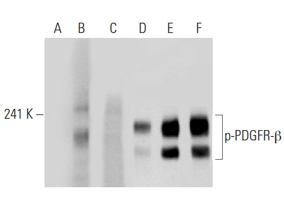 Western blot analysis of PDGFR-β phosphorylation in untreated (A,D), PDGF treated (B,E) and PDGF and lambda protein phosphatase treated (C,F) NIH/3T3 whole cell lysates. Antibodies tested include p-PDGFR-β (Tyr 751)-R: sc-21902-R (A,B,C) and PDGFR-β (11H4): sc-80991 (D,E,F).