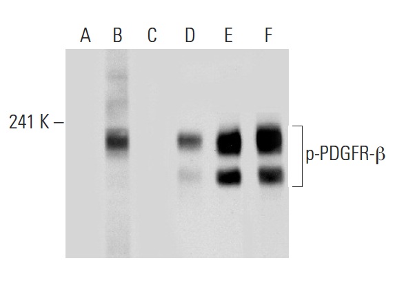 Western blot analysis of PDGFR-β phosphorylation in untreated (A,D), PDGF treated (B,E) and PDGF and lambda protein phosphatase treated (C,F) NIH/3T3 whole cell lysates. Antibodies tested include p-PDGFR-β (Tyr 1009)-R: sc-12908-R (A,B,C) and PDGFR-β (11H4): sc-80991 (D,E,F).