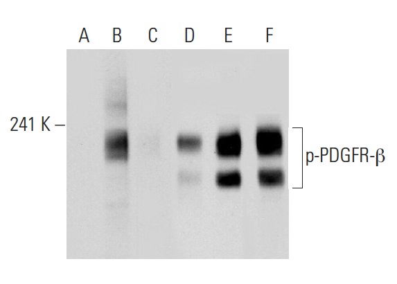 Western blot analysis of PDGFR-β phosphorylation in untreated (A,D), PDGF treated (B,E) and PDGF and lambda protein phosphatase treated (C,F) NIH/3T3 whole cell lysates. Antibodies tested include p-PDGFR-β (Tyr 770)-R: sc-17175-R (A,B,C) and PDGFR-β (11H4): sc-80991 (D,E,F).