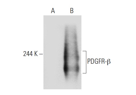 PDGFR-β (11H4): sc-80991. Western blot analysis of PDGFR-β expression in non-transfected: sc-117752 (A) and human PDGFR-β transfected: sc-159386 (B) 293T whole cell lysates.