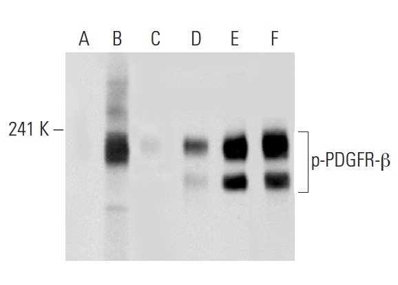 Western blot analysis of PDGFR-β phosphorylation in untreated (A,D), PDGF treated (B,E) and PDGF and lambda protein phosphatase treated (C,F) NIH/3T3 whole cell lysates. Antibodies tested include p-PDGFR-β (Tyr 857)-R: sc-12907-R (A,B,C) and PDGFR-β (11H4): sc-80991 (D,E,F).
