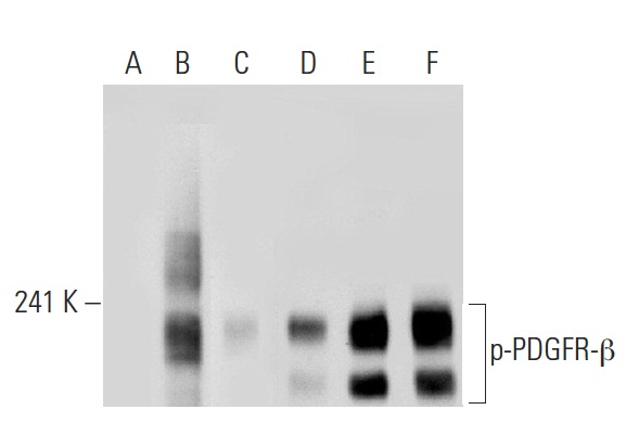 Western blot analysis of PDGFR-β phosphorylation in untreated (A,D), PDGF treated (B,E) and PDGF and lambda protein phosphatase treated (C,F) NIH/3T3 whole cell lysates. Antibodies tested include p-PDGFR-β (Tyr 740)-R: sc-17173-R (A,B,C) and PDGFR-β (11H4): sc-80991 (D,E,F).