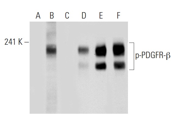 Western blot analysis of PDGFR-β phosphorylation in untreated (A,D), PDGF treated (B,E) and PDGF and lambda protein phosphatase treated (C,F) NIH/3T3 whole cell lysates. Antibodies tested include p-PDGFR-β (Tyr 716)-R: sc-16569-R (A,B,C) and PDGFR-β (11H4): sc-80991 (D,E,F).