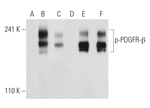 Western blot analysis of PDGFR-β phosphorylation in non-transfected: sc-117752 (A,D), untreated human PDGFR-β transfected: sc-159386 (B,E) and lambda protein phosphatase treated human PDGFR-β transfected: sc-159386 (C,F) 293T whole cell lysates. Antibodies tested include p-PDGFR-β (Tyr 857)-R: sc-12907-R (A,B,C) and PDGFR-β (11H4): sc-80991 (D,E,F).