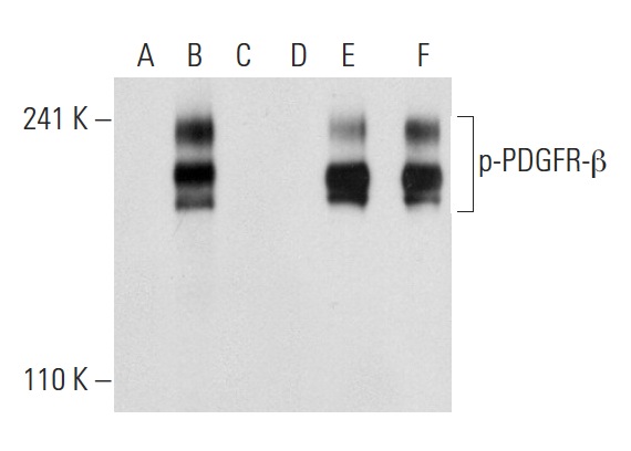 Western blot analysis of PDGFR-β phosphorylation in non-transfected: sc-117752 (A,D), untreated human PDGFR-β transfected: sc-159386 (B,E) and lambda protein phosphatase treated human PDGFR-β transfected: sc-159386 (C,F) 293T whole cell lysates. Antibodies tested include p-PDGFR-β (Tyr 716)-R: sc-16569-R (A,B,C) and PDGFR-β (11H4): sc-80991 (D,E,F).