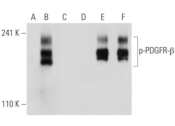 Western blot analysis of PDGFR-β phosphorylation in non-transfected: sc-117752 (A,D), untreated human PDGFR-β transfected: sc-159386 (B,E) and lambda protein phosphatase treated human PDGFR-β transfected: sc-159386 (C,F) 293T whole cell lysates. Antibodies tested include p-PDGFR-β (Tyr 740)-R: sc-17173-R (A,B,C) and PDGFR-β (11H4): sc-80991 (D,E,F).