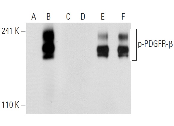 Western blot analysis of PDGFR-β phosphorylation in non-transfected: sc-117752 (A,D), untreated human PDGFR-β transfected: sc-159386 (B,E) and lambda protein phosphatase treated human PDGFR-β transfected: sc-159386 (C,F) 293T whole cell lysates. Antibodies tested include p-PDGFR-β (Tyr 771)-R: sc-17174-R (A,B,C) and PDGFR-β (11H4): sc-80991 (D,E,F).